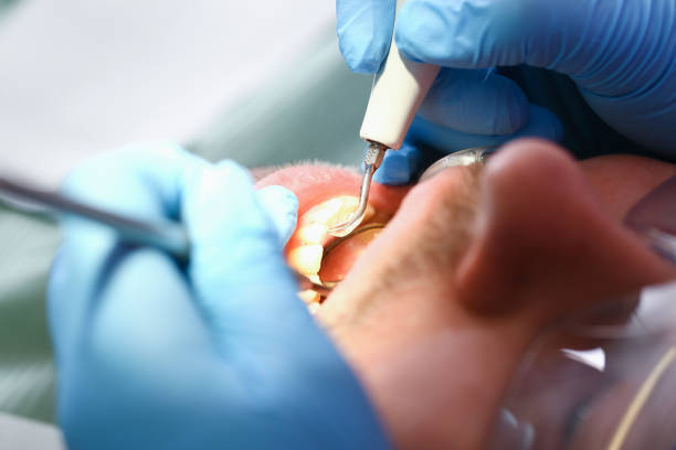 Best Emergency Dental Care for Broken or Chipped Teeth in Lebanon South, PA