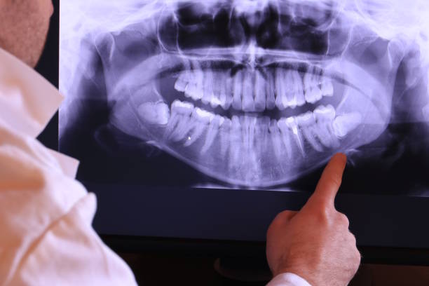 Best Emergency Gum Treatment in Lebanon South, PA